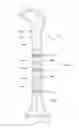 Fig. 04 - System for intramedullary rod fixation and method therefor