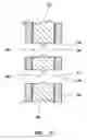 Fig. 06 - Intramedullary nail assembly