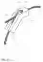 Fig. 12 - Cable and crimp for bone surgery