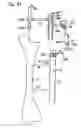 Fig. 14 - Support for locating instrument guides