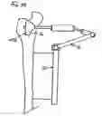 Fig. 18 - Support for locating instrument guides