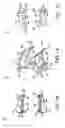 Fig. 02 - Arthroplasty revision device and method