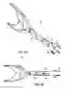 Fig. 04 - Arthroplasty revision device and method