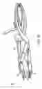 Fig. 05 - Arthroplasty revision device and method
