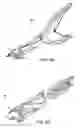 Fig. 09 - Arthroplasty revision device and method