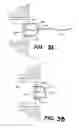 Fig. 03 - Apparatus and methods for the treatment of the intervertebral disc
