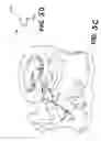 Fig. 07 - Apparatus and methods for the treatment of the intervertebral disc