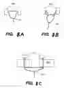Fig. 13 - Apparatus and methods for the treatment of the intervertebral disc