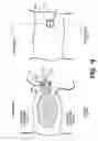 Fig. 14 - Apparatus and methods for the treatment of the intervertebral disc