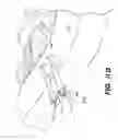 Fig. 19 - Apparatus and methods for the treatment of the intervertebral disc