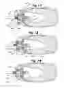 Fig. 25 - Apparatus and methods for the treatment of the intervertebral disc