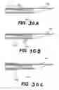 Fig. 33 - Apparatus and methods for the treatment of the intervertebral disc