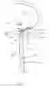 Fig. 48 - Apparatus and methods for the treatment of the intervertebral disc