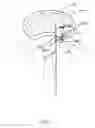 Fig. 53 - Apparatus and methods for the treatment of the intervertebral disc