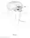 Fig. 55 - Apparatus and methods for the treatment of the intervertebral disc