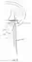 Fig. 63 - Apparatus and methods for the treatment of the intervertebral disc