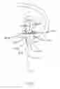 Fig. 66 - Apparatus and methods for the treatment of the intervertebral disc