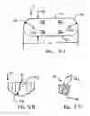 Fig. 09 - Multiple suture anchor delivery device, suture anchor delivery kit and associated method
