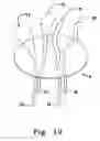 Fig. 20 - Multiple suture anchor delivery device, suture anchor delivery kit and associated method