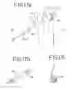 Fig. 14 - Method of arthroscopic or open rotator cuff repair using an insertional guide for delivering a suture pin
