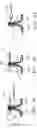 Fig. 45 - Surgical repair kit and its method of use