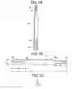 Fig. 04 - Minimally invasive tissue expander systems and methods