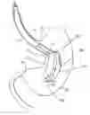 Fig. 01 - Intragastric space filler