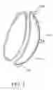 Fig. 03 - Intragastric space filler