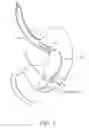 Fig. 04 - Intragastric space filler