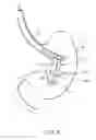 Fig. 05 - Intragastric space filler