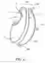Fig. 07 - Intragastric space filler