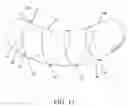 Fig. 12 - Intragastric space filler