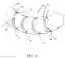 Fig. 13 - Intragastric space filler