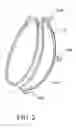 Fig. 03 - Intragastric space filler