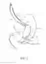 Fig. 04 - Intragastric space filler