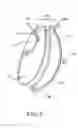 Fig. 07 - Intragastric space filler