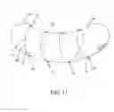 Fig. 12 - Intragastric space filler