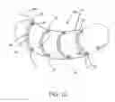 Fig. 13 - Intragastric space filler