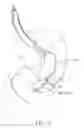 Fig. 04 - Intragastric space filler