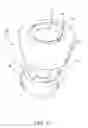 Fig. 10 - Intragastric space filler