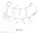Fig. 12 - Intragastric space filler