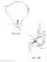 Fig. 17 - Intragastric space filler
