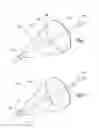 Fig. 02 - MULTI-WIRE EMBOLIC PROTECTION FILTERING DEVICE