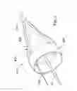Fig. 08 - MULTI-WIRE EMBOLIC PROTECTION FILTERING DEVICE