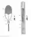Fig. 03 - Embolic protection device having a filter