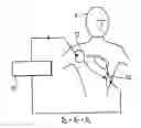 Fig. 01 - Compensation for cardiac shunt currents during defibrillation