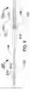 Fig. 10 - Implantable medical system with long range telemetry