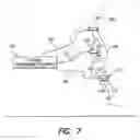 Fig. 12 - Treatment of movement disorders by brain stimulation