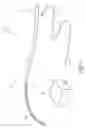 Fig. 02 - Systems and methods for treating a hollow anatomical structure