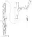 Fig. 04 - Systems and methods for treating a hollow anatomical structure